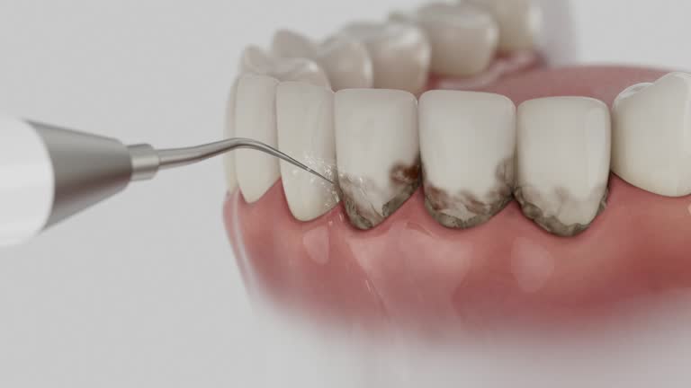 Reliable Dental contractor in Sperry, OK by Smile Center Dentistry
